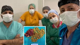 Aylardır onlarla yaşıyormuş! Doktorları bile şaşkına çevirdi: Tam 1284 adet çıkarıldı... Her şey karın ağrısıyla başlamıştı