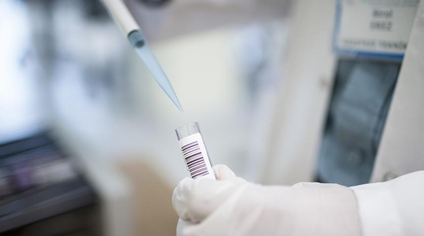 Dünyayı titreten maymun çiçeği virüsünün adı değişiyor! Dünya Sağlık Örgütü açıkladı