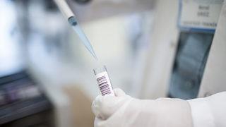 Dünyayı titreten maymun çiçeği virüsünün adı değişiyor! Dünya Sağlık Örgütü açıkladı