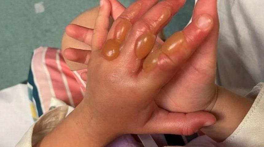 Okul gezisinde hayatının kabusunu yaşadı! Bir bölge o bitkiye karşı teyakkuza geçti