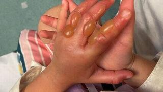 Okul gezisinde hayatının kabusunu yaşadı! Bir bölge o bitkiye karşı teyakkuza geçti