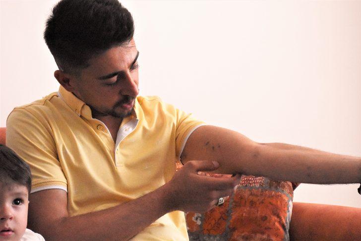 Aksaraylı Uzman Çavuş Veysel Özdemir, iyileşip görevine dönmek istiyor G2