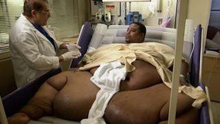 Kilosu tam yarım ton! Evinden çıkartmak için duvarı yıkmak zorunda kaldılar: Tam 4 yıldır yıkanmıyorum