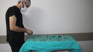 Midesinden çıkanları görenler gözlerine inanamadı! 83 tane 1 lira... Üstelik dahası da var