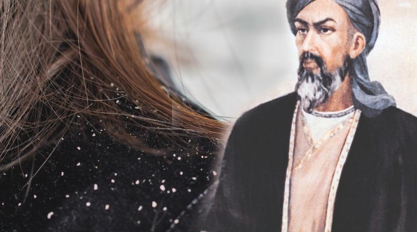 Saçtaki kepek sorununa İbn-i Sina’dan kökten çözüm: Tamamen doğal ve ucuz