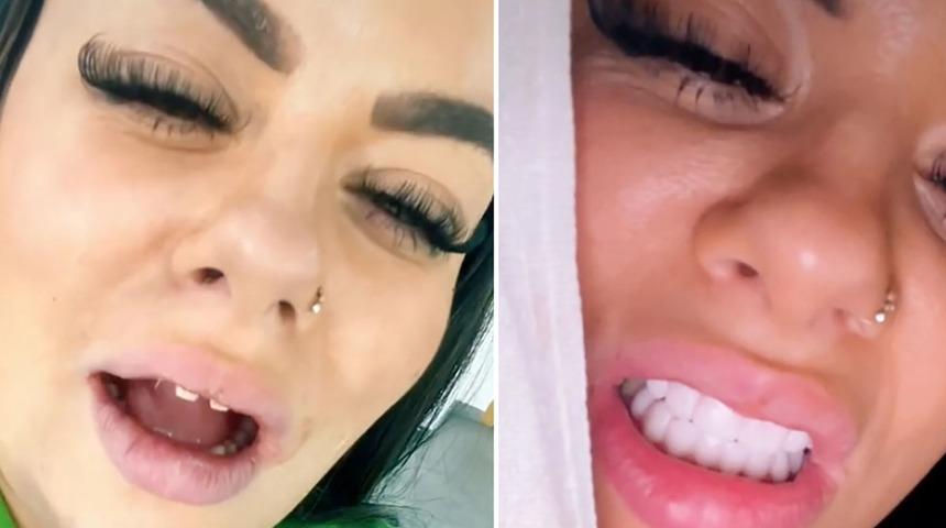 &Uuml;nl&uuml; fenomen T&uuml;rkiye&rsquo;ye geldi! Yaşadıklarını anbean yayınladı: Acı verici 