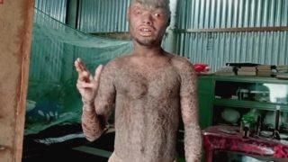 Her hafta deri değiştiriyor! Gözlerini bile kırpamıyor: Çocuklar benden korkuyor