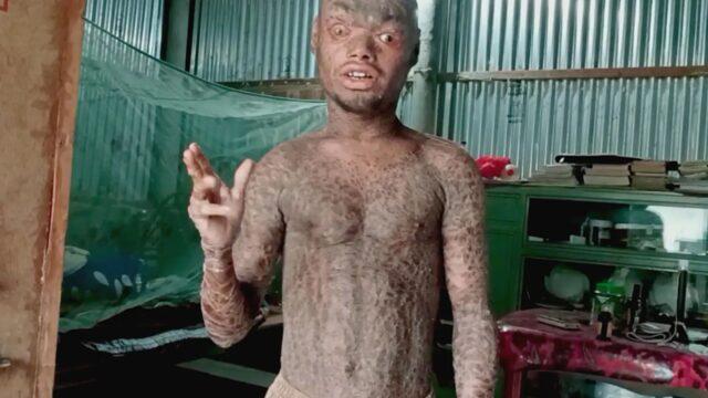 Her hafta deri değiştiriyor! Gözlerini bile kırpamıyor: Çocuklar benden korkuyor