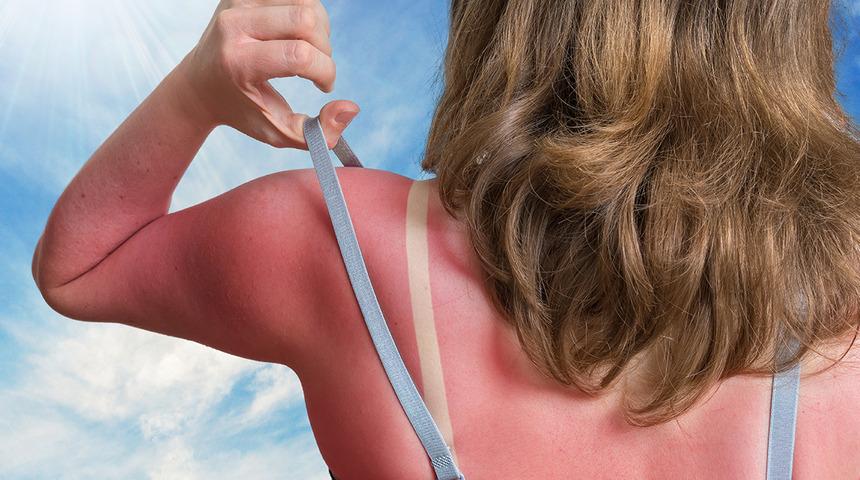 Yanlış yapıyorsunuz: Cilt lekelerinden uzak durmak için uyguladığınız güneş kremi miktarına dikkat!