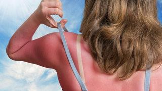 Yanlış yapıyorsunuz: Cilt lekelerinden uzak durmak için uyguladığınız güneş kremi miktarına dikkat!