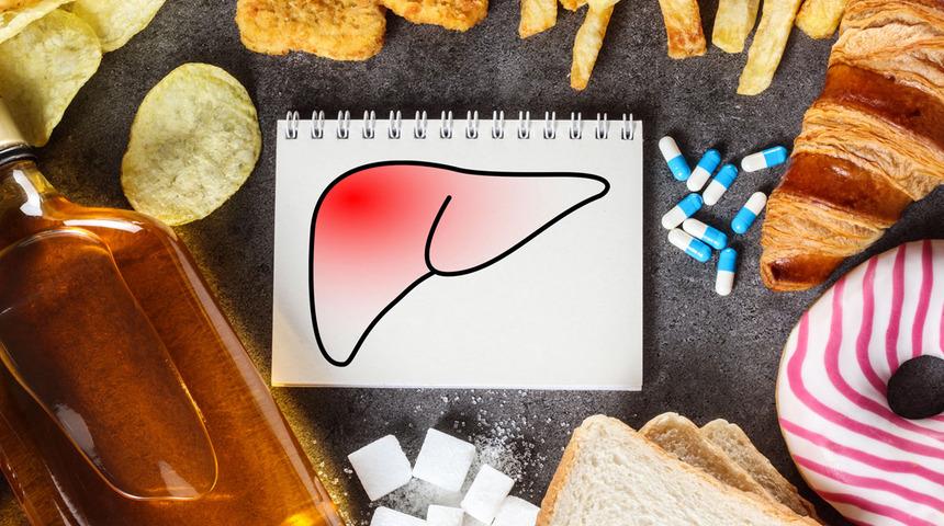 Kendinize bu kötülüğü yapmayın! Karaciğer yağlanmasına neden olan yiyecekler