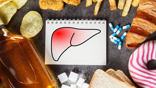 Kendinize bu kötülüğü yapmayın! Karaciğer yağlanmasına neden olan yiyecekler