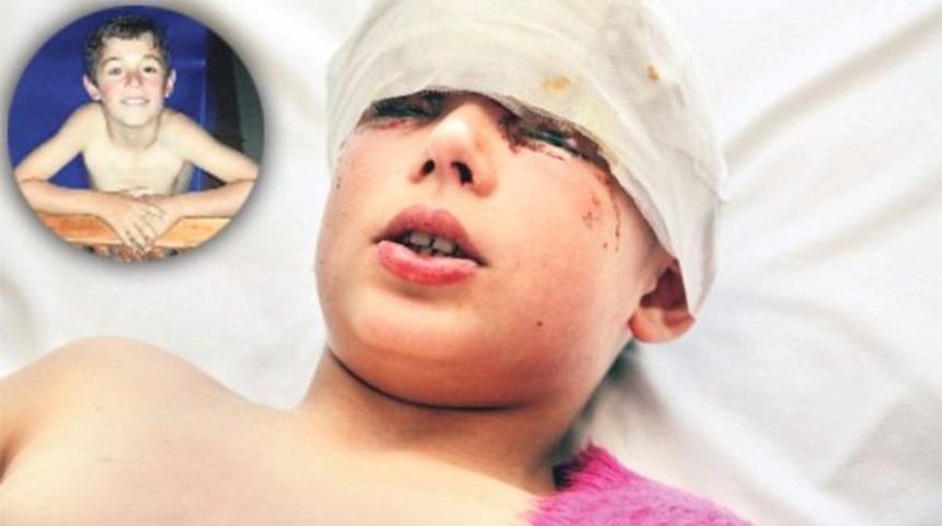 ‘Gözyaşlarım bile bana acı veriyor’