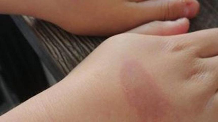 Sosyal medyada gördüğü akımı denemek istedi! Hayatının en büyük acısını yaşadı