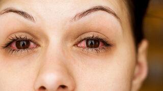 Göz ardı etmeyin! Kalıcı hasarlara yol açabiliyor  