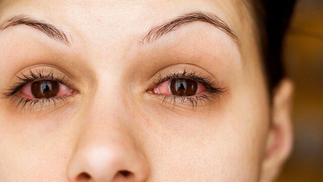 Göz ardı etmeyin! Kalıcı hasarlara yol açabiliyor  