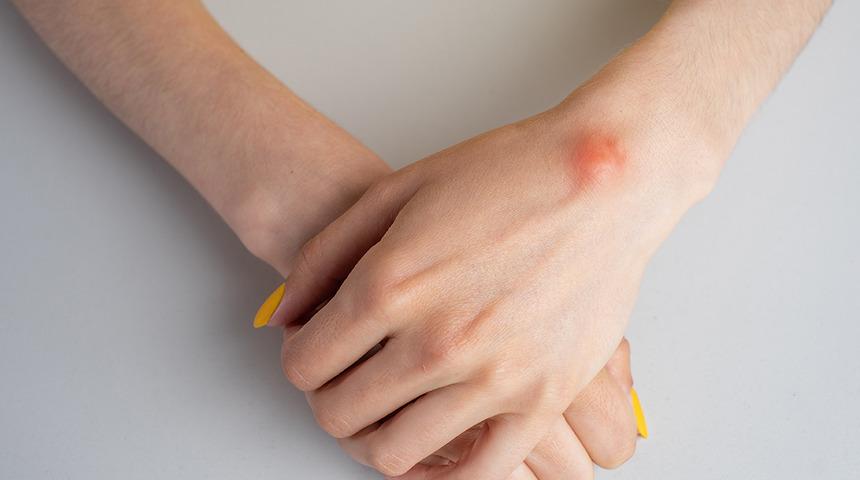 Önemsiz diyerek geçmeyin! Mutlaka doktora başvurun  