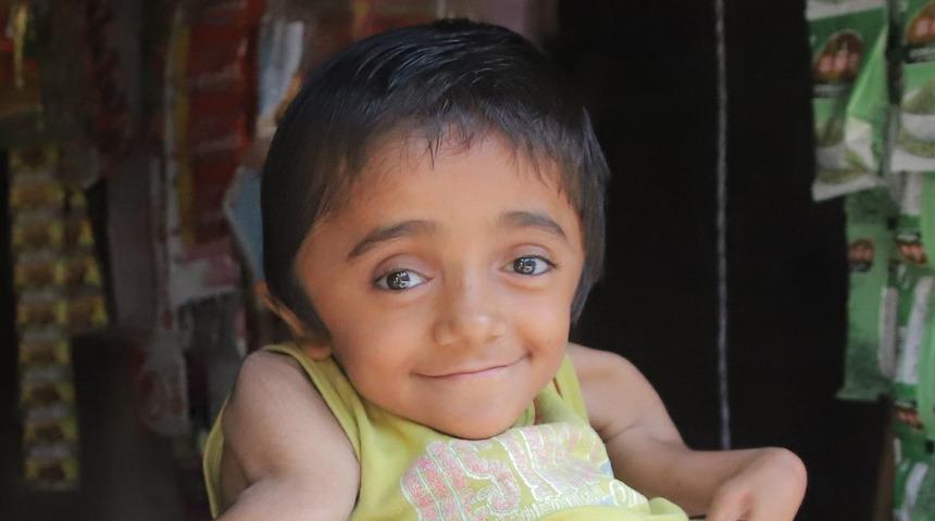 Kimse ona dokunamıyor! Hintli 12 yaşındaki kız ‘camdan’ kemikleriyle yaşam mücadelesi veriyor