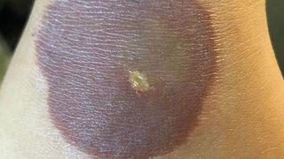 Sosyal medya trendi için kendini yaktı: Her şey 10 saniyede oldu