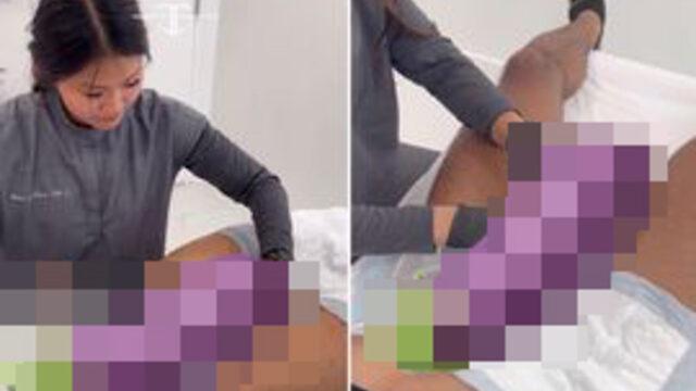 Bir anda popüler olmayı başardı! Sosyal medyanın yeni trendi: Penis dolgusu