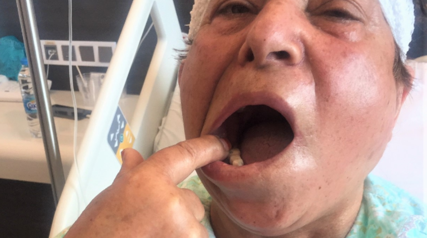 Bu yüzden sağlam dişlerinden oldu! Delirten hastalığı 70’inde yendi: Dünya varmış