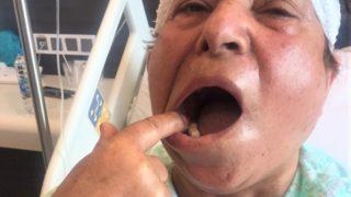 Bu yüzden sağlam dişlerinden oldu! Delirten hastalığı 70’inde yendi: Dünya varmış