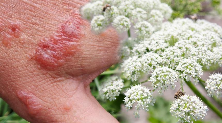 Dokunan yanıyor: Yanlış yaparsanız yara içinde kalırsınız! Doğru kullanırsanız faydaları inanılmaz