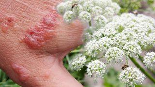 Dokunan yanıyor: Yanlış yaparsanız yara içinde kalırsınız! Doğru kullanırsanız faydaları inanılmaz