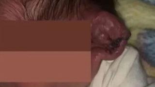 Doğum esnasında elektrikler kesildi! Bebeğin kulağı...