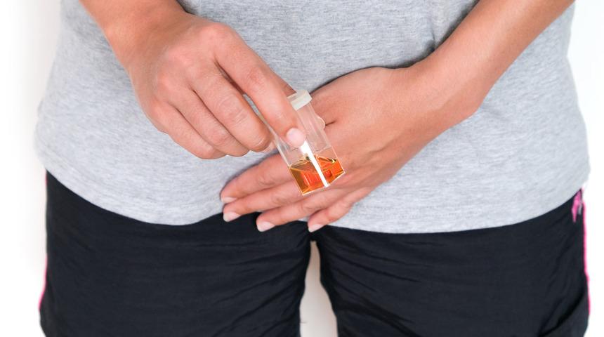 İdrarınızın rengi sağlığınız hakkında önemli ipucu veriyor: Yardıma ihtiyacınız olabilir!