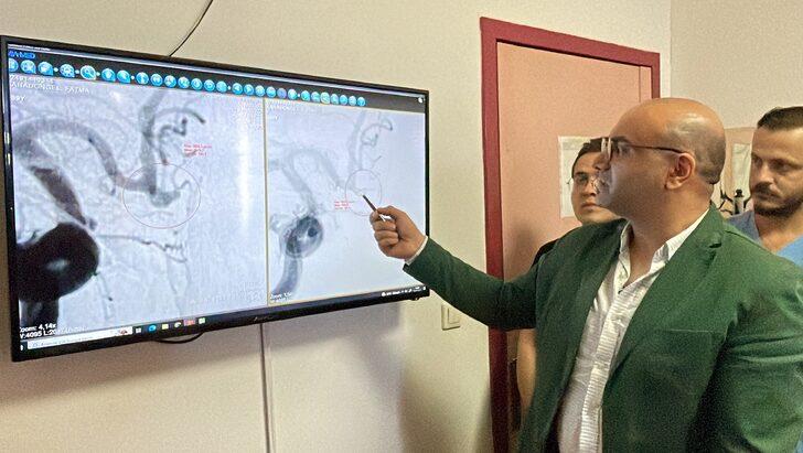 Beyninde damar baloncuğu bulunan hasta damar içi tedavi ile sağlığına kavuştu G1