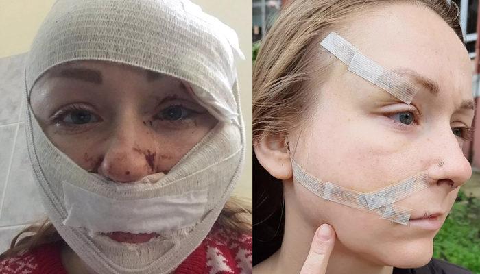 Karısının yüzünü falçatayla yaralamıştı! Sanıktan şok istek: Mağdurum, tahliye edin