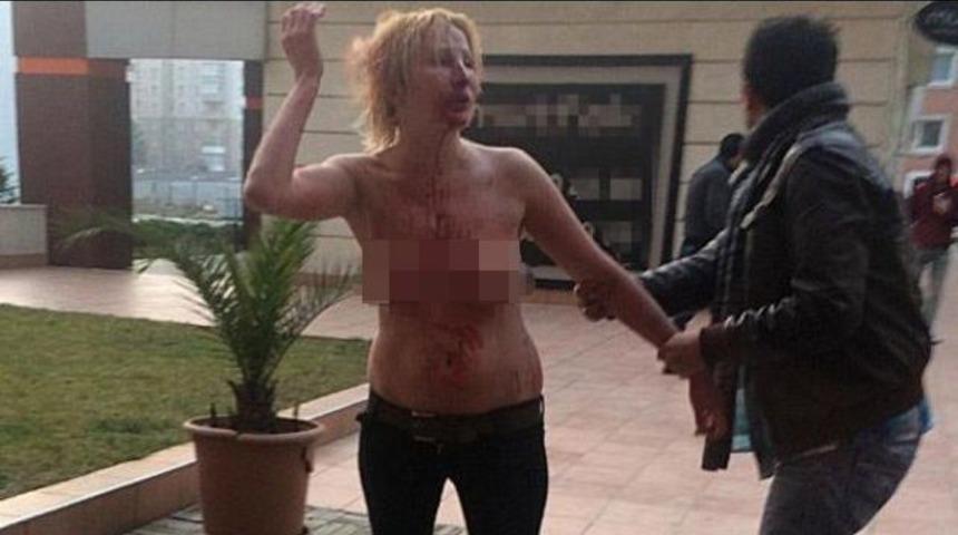 Yarı &ccedil;ıplak Rus kadının &ccedil;ığlıklarıyla uyandılar