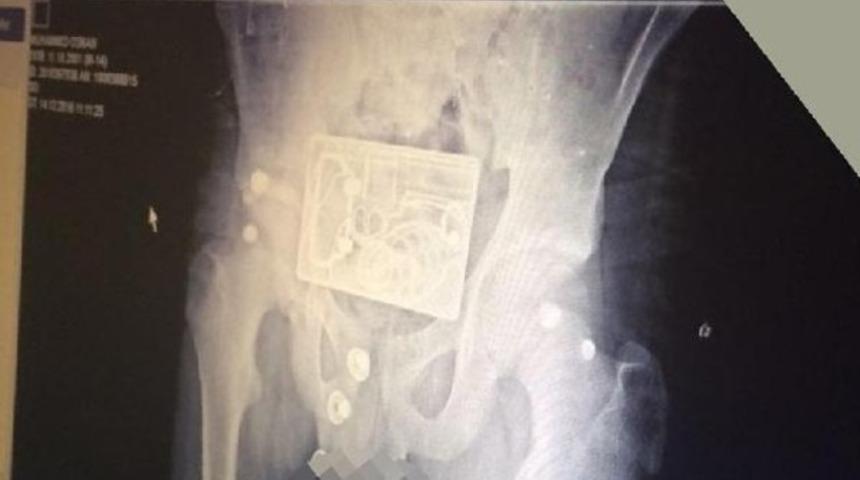 Kemer tokası y&uuml;z&uuml;nden canlı bomba sanıldı