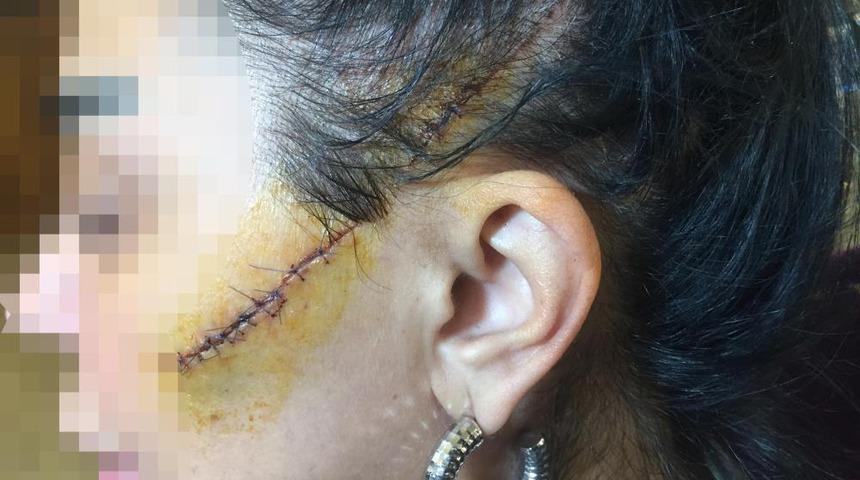 Eski sevgilisinin yüzünü usturayla kesmişti! Hakime bakın ne söyledi