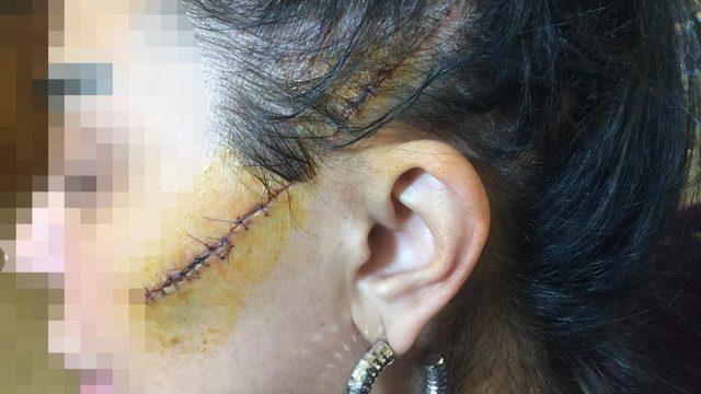 Eski sevgilisinin yüzünü usturayla kesmişti! Hakime bakın ne söyledi