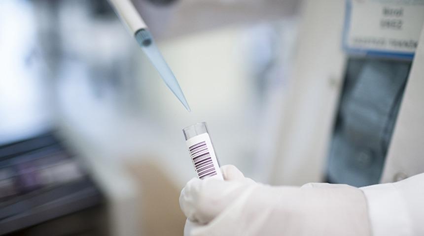 Maymun çiçeği virüsü dünyayı titretmeye devam ediyor! DSÖ toplandı, küresel acil durum ilanı...