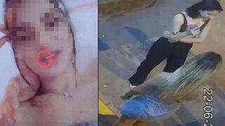 Altın dişi sayesinde tespit edildi! Gazinoda eğlenirken yakalandı