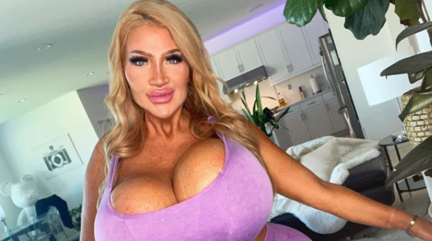 Sosyal medya fenomeni Allegra Cole, estetik ameliyatlardan önceki halini paylaştı! Görenler şoke oldu