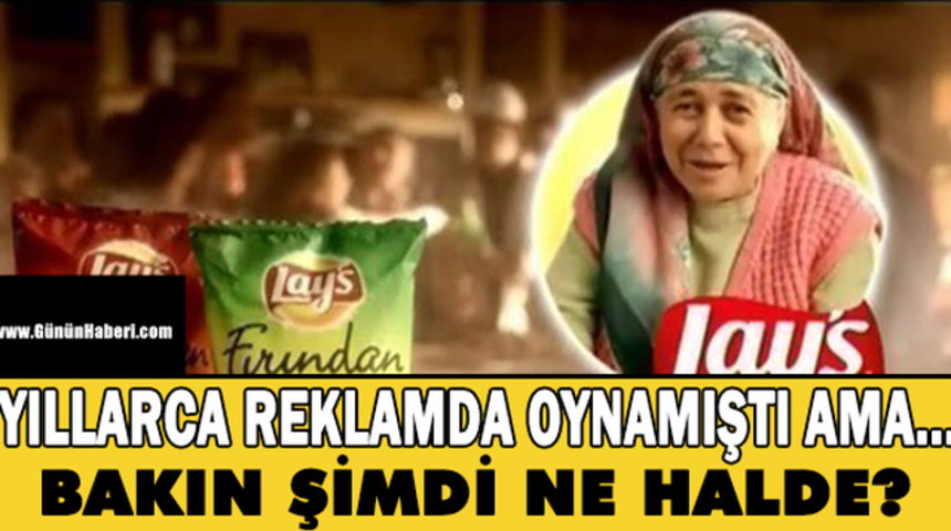 Bir Zamanlar Reklamların Aranan Y&uuml;z&uuml;yd&uuml; Bakın Şimdi Ne Halde!