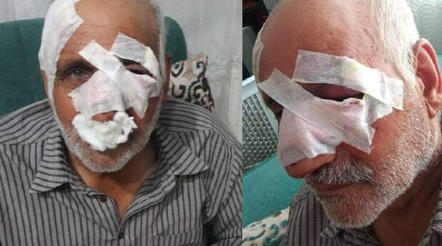 Sokak köpekleri yaşlı adamı tanınmaz hale getirdi! Yoğun bakımda yaşam savaşı veriyor