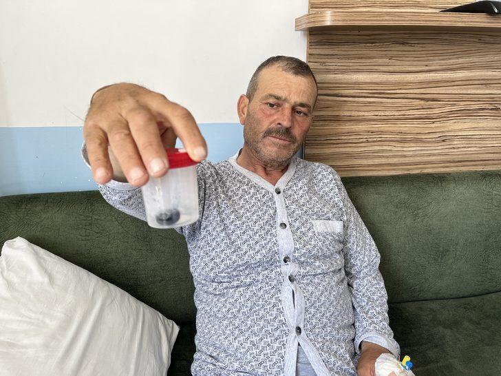 Isparta'da mide rahatsızlığına iyi gelmesi için yuttuğu zeytin bağırsağını tıkadı G2