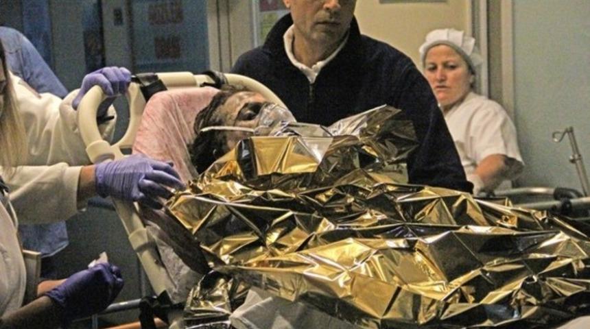 Tartıştığı eşini benzin döküp yaktı