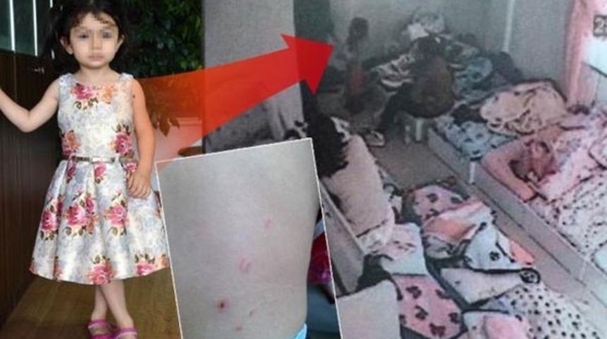 Kreşteki k&ouml;t&uuml; muamele, bilirkişi raporuna yansıdı