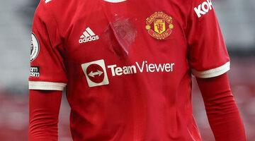 Yıldız futbolcu linç yedi! Kariyeri bitiyordu