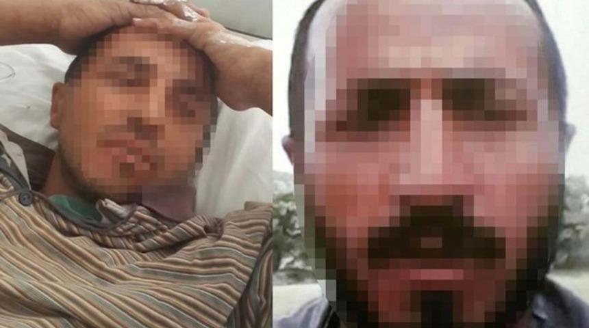 Cinayet zanlısı domuz sanılarak vuruldu