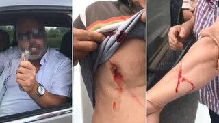 Trafikte dehşet: Tartıştığı 3 kişiyi falçatayla yaraladı! 'Doğrarım'