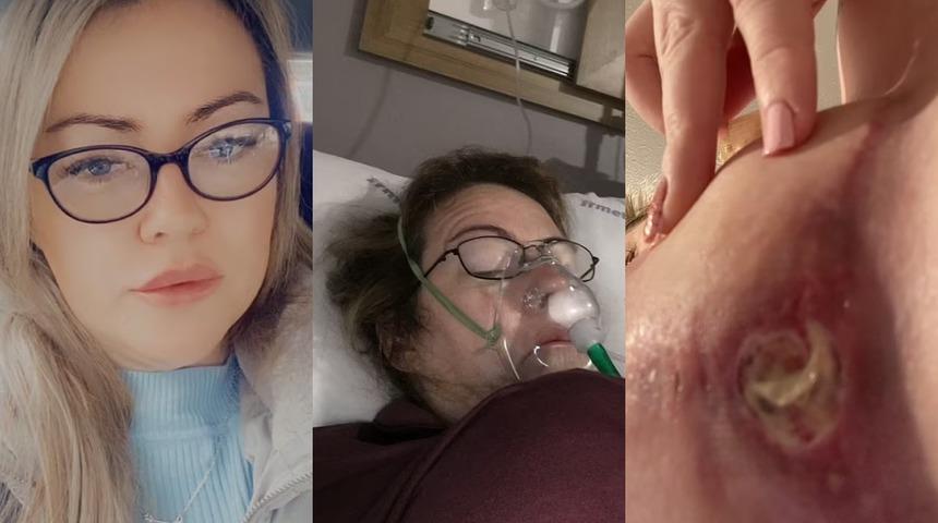 Güzelleşmeye geldi, dehşeti yaşadı! Korkunç yara izleri