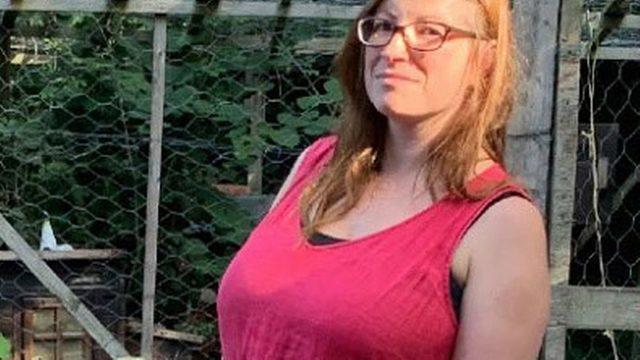 Devasa göğüsleri hayatını zindan etmişti! 850 gramlık göğüslerinden kurtulunca hayatı değişti