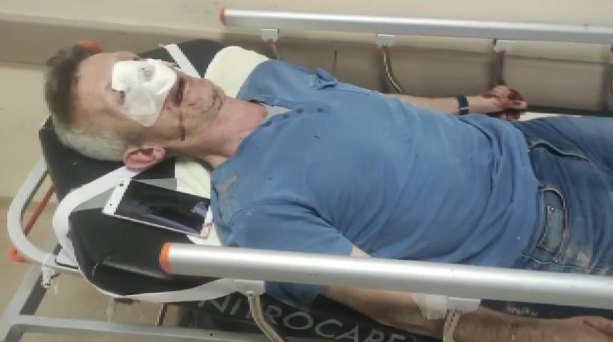 Yöneticiden site sakinine röportaj dayağı! 'Sen benim hakkımda konuşuyormuşsun' deyip saldırdı